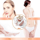 [2020 Newest Version]Women Waterproof Painless Hair Remover,Cordless Electric Shaver Leg Hair Removals Trimmer Epilator,Good Finishing and Well Touch for Leg Face Lips Body Arm Bikini Area As Seen On - wooelnet