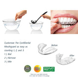 The ConfiDental - Pack of 5 Moldable Mouth Guard for Teeth Grinding Clenching Bruxism, Sport Athletic, Whitening Tray, Including 3 Regular and 2 Heavy Duty Guard (3 (lll) Regular 2 (II) Heavy Duty) - wooelnet