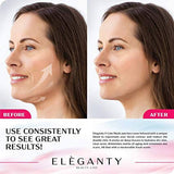 Eleganty V-line Lifting Mask 6pcs Pack Double Chin Reducer Face Contour Neck Jaw Lifting Gel Patch Wrinkle Anti Aging Skin Care Collagen Chin Up Firming and Slimming Treatment for Women and Men - wooelnet